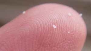 Read more about the article ¿Qué Aspecto tiene los Huevos de Pulga y entonces qué Hago?