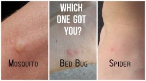Read more about the article Mordeduras de Araña Vs Mordeduras de Bichos de Cama: ¿Cuál es la Diferencia?