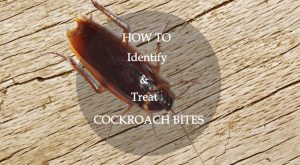 Read more about the article Guía Definitiva de la Picadura de Cucaracha: ¿Cómo Identificar y Tratar las Picaduras de Cucaracha (Naturalmente)?