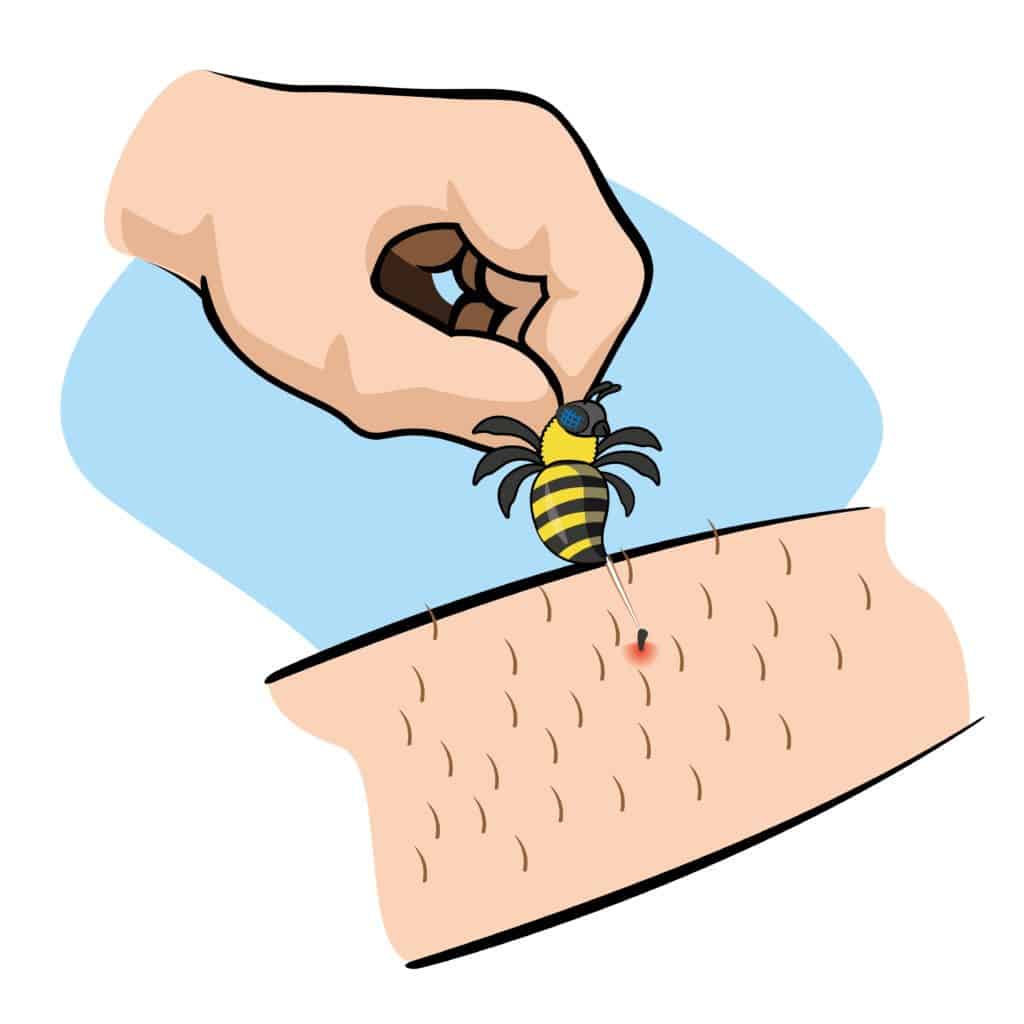 Read more about the article ¿Cómo Tratar una Picadura de Abeja con Seguridad?