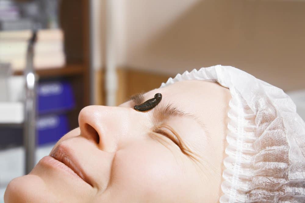 Read more about the article Sanguijuela — Beneficios Asombrosos de la Terapia de Sanguijuela y los Tratamientos