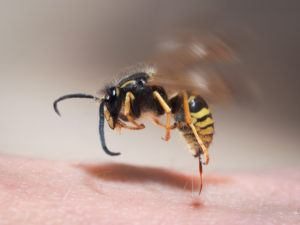 Wasp picadura saca de la piel humana.