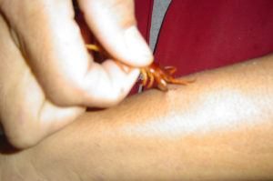 picadura de ciempiés